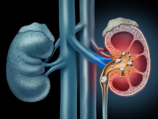 Navigating Nephrology Care: Tips and Precautions for Kidney Health in 2024